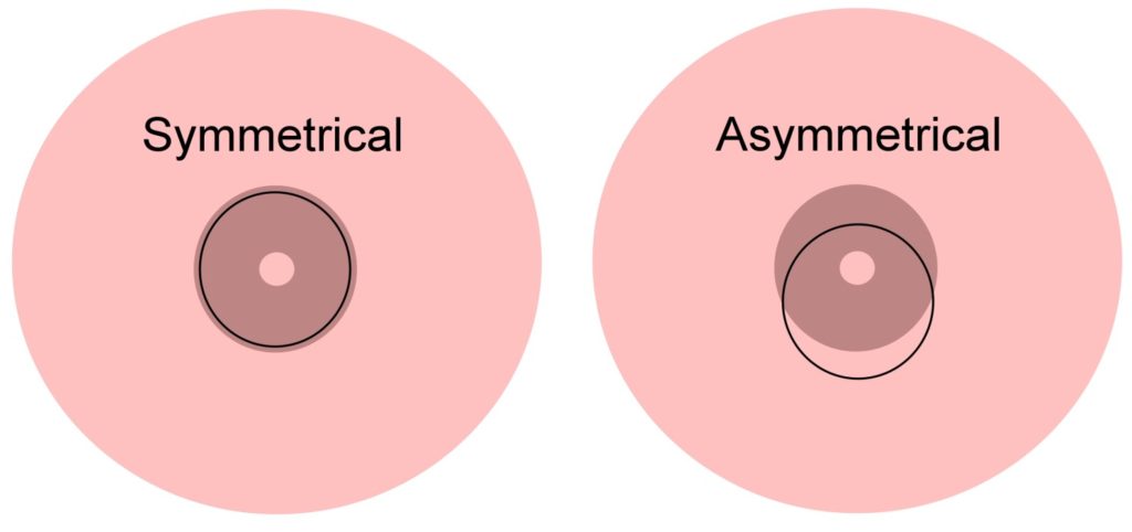 Symetrical Asymetrical Latch Breastfeeding